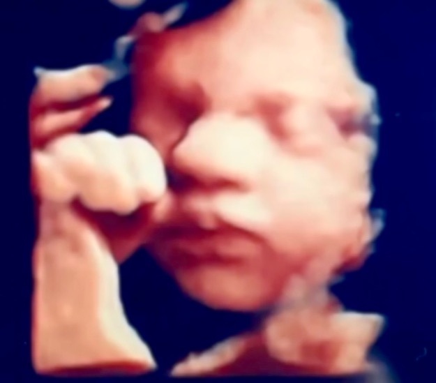 3D/4D/5D Live Sonogram & Ultrasound Services in Tampa Baby Scene